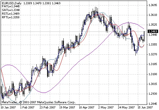 MetaTrader 4用のDigits_Commentインジケーターの活用法