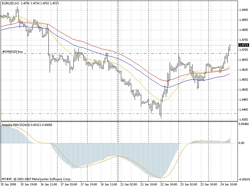 MACD 히스토그램
